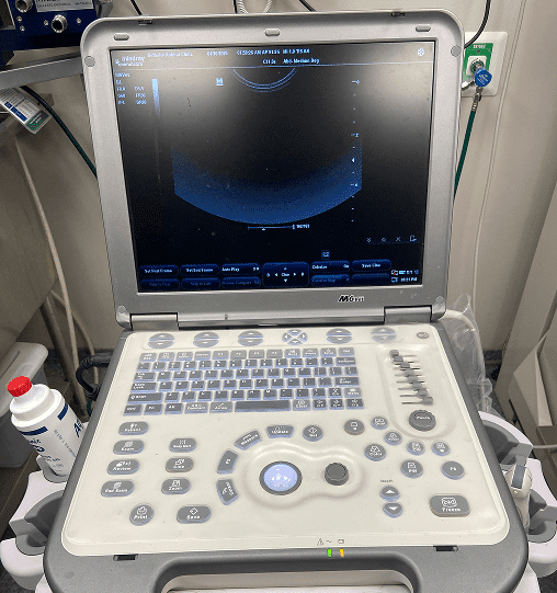 A portable ultrasound machine displays a black-and-white scan image on its screen, with various control buttons and a gel bottle visible beside it.